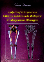  Aşağı ətraf arteriyalarının okklüziv xəstəliklərində multispiral kt müayinəsinin əhəmiyyəti